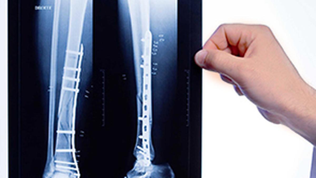 Bone Age Matters: Its Impact on Medicine, Law, and Sports